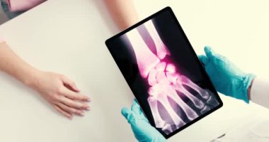 Kaliteli bir tıp uzmanı, tablette gösterilen ayak bileği yaralanmasının röntgenini dikkatlice inceliyor.