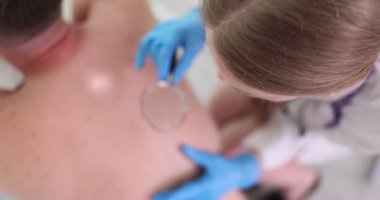 Kadın dermatolog hastanın sırtındaki sivilceleri muayene ediyor. Doktor sivilcelerin boyutunu ve kızarıklığını ölçmek için büyüteç kullanıyor. Yavaş çekim