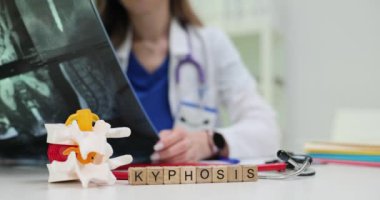 Yetenekli bir doktor bir röntgeni inceler ve daha iyi anlamak için omurilik modeli kullanarak kifozu tartışır.
