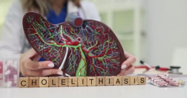 Karaciğeri vasküler sistemle birlikte tasvir eden anatomik bir model, kolelithias üzerinde duruluyor.
