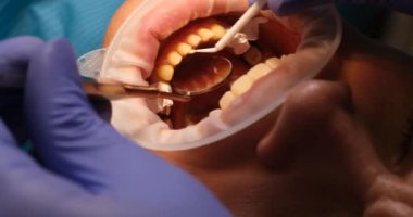 Mavi koruyucu eldivenli yetenekli dişçi hastanın dişlerini muayene eder. Deneyimli doktor hasta dişlerini randevuda kaplama için hazırlar.