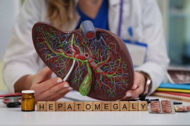 Karaciğer anatomisini ve temel tıbbi bağlamı vurgulayan hepatomegali gösteren görsel bir gösterim