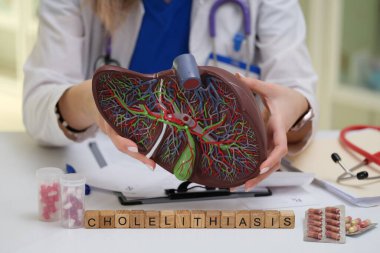 Yetenekli bir doktor spesifik anatomik özelliklere sahip detaylı bir karaciğer modeli kullanarak kolelithiasis 'i gösterir.