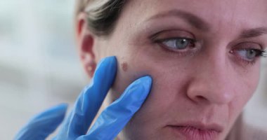 Eldivenli dermatolog hastanın yanağındaki doğum lekesini kontrol etti. Doktor, klinikteki randevuda yüz dokusu üzerine spesifik pigmentasyon hedefler