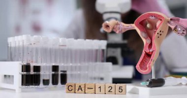 Gelişmiş laboratuvar ekipmanları ve teknikleri kullanılarak jinekolojik çalışmalarda CA125 işaretlerinin derinlemesine araştırılması