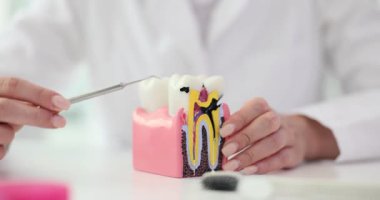 Diş hekimine göre insan dişi masasında anatomik modelden zarar görmüş. Doktor diş hastalıkları konusunda uyardı. Klinikteki hasta için tehlike arz ediyor.