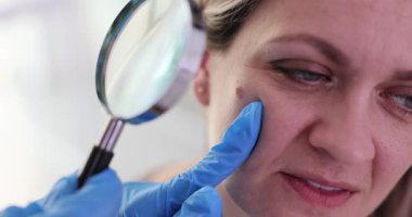 Dermatolog, hasta bir bayanın yanağındaki sivilceyi incelemek için büyüteç kullanıyor. Doktor, derideki sivilcenin boyutunu ve nedenlerini analiz eder. Yavaş çekim