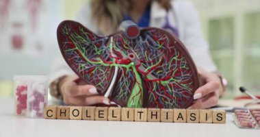 Kadın profesyonel, karaciğer anatomik modelinin ahşap küpler kullanarak kolelithiasis 'i tartıştığını gösteriyor. Klinik ortamdaki hasta danışmanlığı