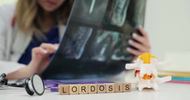 Tahta küplerin Lordosis 'i ve hastanın omurga röntgeni görüntülerine sahip bir doktor. Doktorlar hastanede omurilik eğriliği hastalığı teşhisi koydular.