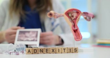 Jinekolog rahmin anatomik modelinin yanında Adnexitis teşhisi konan bir hastanın ultrason taramasını tutuyor. Klinikte hastalık ve tedavinin açıklaması
