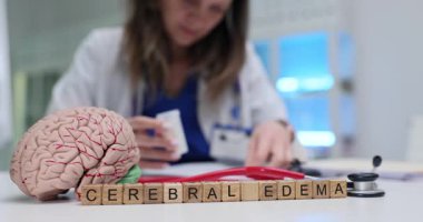 Tıbbi uzmanlar beyin anatomik modelinin klinikteki masasına koyduğu beyin ödemini analiz ediyor. Nörolojik duruma odaklan.