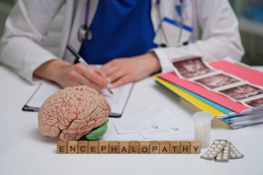 Bir tıp uzmanı beyin modeli ve analiz için kapsamlı notlar kullanarak ensefalopati üzerinde çalışıyor.