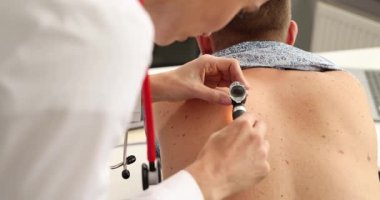 Dermatolog, erkek hastaların sırt derisini el yapımı dermatoskop kullanarak inceliyor. Doktor asimetri ve renk değişiklikleri için doğum lekelerini ve benleri kontrol eder