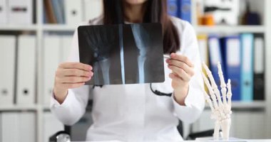 Kadın travmatolog klinikte kırık bilek röntgenini tutuyor. Kadın doktor hastanın iyileşmesini kontrol ediyor.