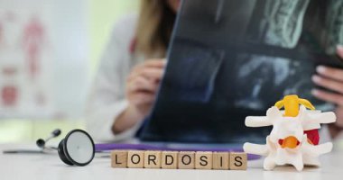 Tahta küplerin Lordosis 'i ve hastanın omurga röntgeni görüntüsünü tutan bir doktor. Doktorlar, tıbbi taramaları inceleyen omurilik eğriliği hastalığına teşhis koyuyor.