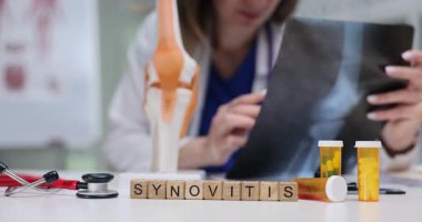Kadın profesyonel, Synovitis yakınlarındaki röntgende küp ve masandaki eklem modelini inceliyor. Sinoviyal zar iltihabının teşhisi ve tedavisi
