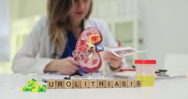Tahta küplere göre böbrek modeli ve idrar kabının yanında Urolithiasis var. Kadın ürolog, böbrek taşı sorununu yakından inceleyen şemayı kontrol etti.