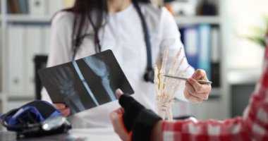 Radyolog muayene sırasında el röntgeni ve kemik modeli gösteriyor. Uzman, bilek yapısının terapi seçeneklerini ve programlamasını açıkladı