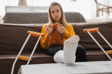 Kırık bacak. Kanepede oturan kırık bacaklı genç kız. Evdeki kırık bacağından iyileşen üzgün küçük çocuk. Alçı ve koltuk değneklerini rehabilitasyon için kullanan bir kız. Kaza yaralanması, kırık tedavisi.