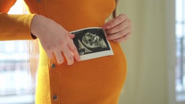 Doğum öncesi ultrason taraması. Hamile kadın elleri karnında doğmamış bebeğin ultrason fotoğrafını tutuyor. Fetüs taraması yapan mutlu anne adayları. Genç anne hamileliğin tadını çıkarıyor. Annelik
