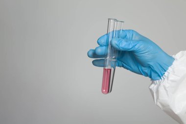 Laboratory worker holding test tubes with substance samples for analysis on gray background. Closeup.