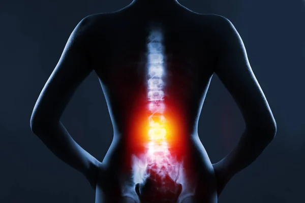人間の背景にX線で背骨 腰椎は赤黄色で強調表示されます — ストック写真