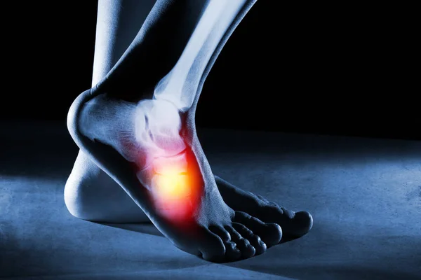 Menschliche Fußknöchel Und Bein Röntgenbild Auf Blauem Hintergrund Der Fußknöchel — Stockfoto