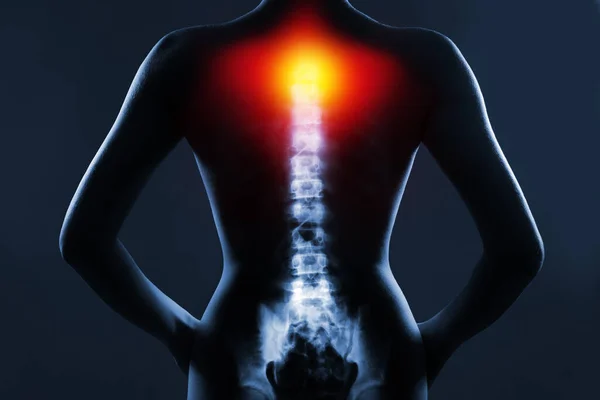Mavi Arka Planda Röntgende Insan Omurgası Boyun Omurgası Kırmızı Sarı — Stok fotoğraf