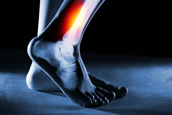 人的脚脚踝和腿在蓝色背景的X光下 脚脚踝被红黄相间的颜色所衬托 — 图库照片
