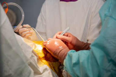 Cerrahlar ameliyat yaparlar. Operasyondan gerçek fotoğraflar. Gerçek bir ameliyathane. Yüksek kalite fotoğraf
