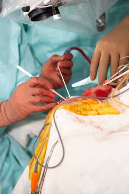 Cerrahlar ameliyat yaparlar. Operasyondan gerçek fotoğraflar. Gerçek bir ameliyathane. Yüksek kalite fotoğraf