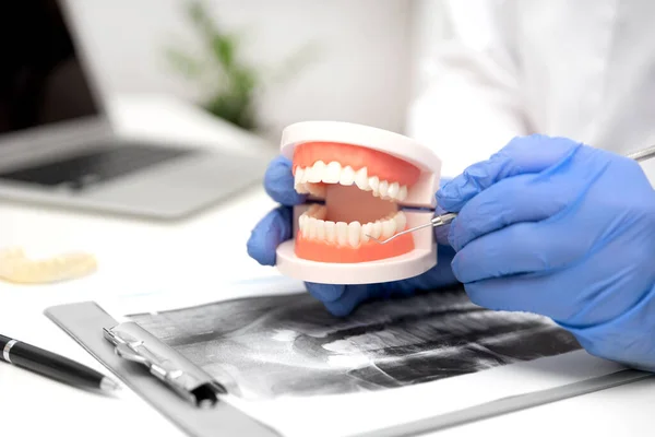 Zahnarzt Zeigt Problemzonen Bei Zähnen Künstlichen Kiefer — Stockfoto