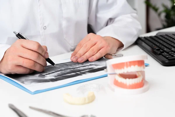 Zahnarzt Zeigt Problemzonen Bei Zähnen Künstlichen Kiefer — Stockfoto