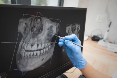 Klinikte diş muayenesi. Diş hekimi dijital tablet ekranda diş röntgeni gösteriyor. 3D tomografi teknolojisi.