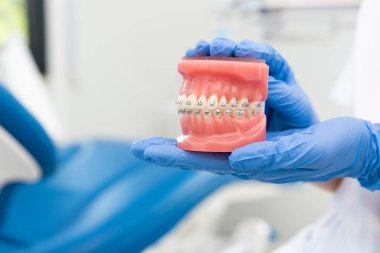 Dişçi, bir insanın diş modelini tutuyor. Modeli pembe ve diş telleri var. Dişçi mavi eldiven giyiyor.