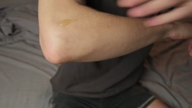 Bir erkek eklem ağrısından korunmak için dirseklerine eklem kremi sürer. Koruyucu tıp kavramı. Yüksek kalite 4k görüntü