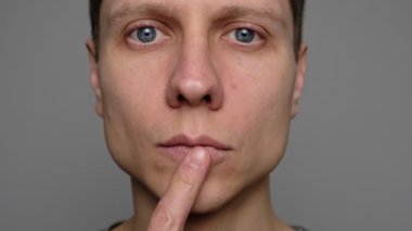 Genç bir adamın parmaklarıyla kuru dudakları göstererek nemlendirme ihtiyacını vurgulaması. Merhemle nemlendirilmesi gereken yarık, kuru dudaklar.