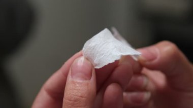 Yüzeyde çıkarılmış pislikleri gösteren siyah başlık çıkartıldıktan sonra burun gözeneklerinin yakın plan çekimleri. Sivilce problemi, boşalma sorunu