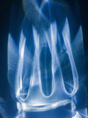 Duvarda mavi aleve benzeyen mavi plastik bir şişenin soyut yansıması..