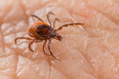 Close-up of deer tick on human skin detail in background. Ixodes ricinus or scapularis. Female parasitic mite on textured epidermis. Carrier of infectious diseases as encephalitis or Lyme borreliosis.  clipart