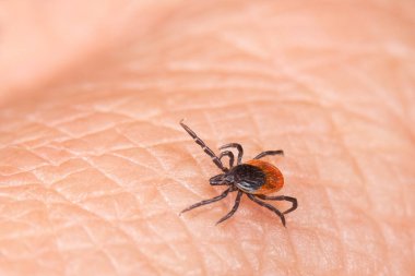Parazit Hint fasulyesi, siyah bacaklı ya da insan derisi üzerinde geyik kenesi. Ixodes. Parazit böcek maytı - bakteriyel ya da viral patojen taşıyıcı. Lyme hastalığı veya kene kaynaklı beyin iltihabı bulaşma tehlikesi.