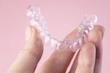 ortodontik tedavi, görünmez diş telleri, yeni ortodontik teknoloji, oklüzyonal atel