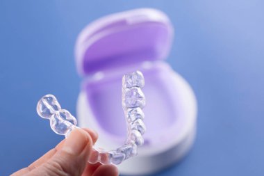 ortodontik tedavi, görünmez diş telleri, yeni ortodontik teknoloji, oklüzyonal atel