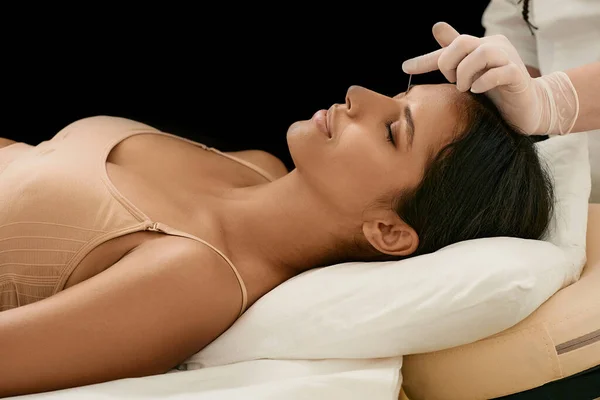 Baş Ağrısı Tedavisi Için Bir Kadının Kafasına Akupunktur Iğnesi Batırmak — Stok fotoğraf