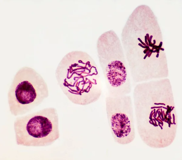 Mitózis Könnyű Mikrográf Sejtek Gyökér Csúcsa Egy Széles Babnövény Vicia — Stock Fotó