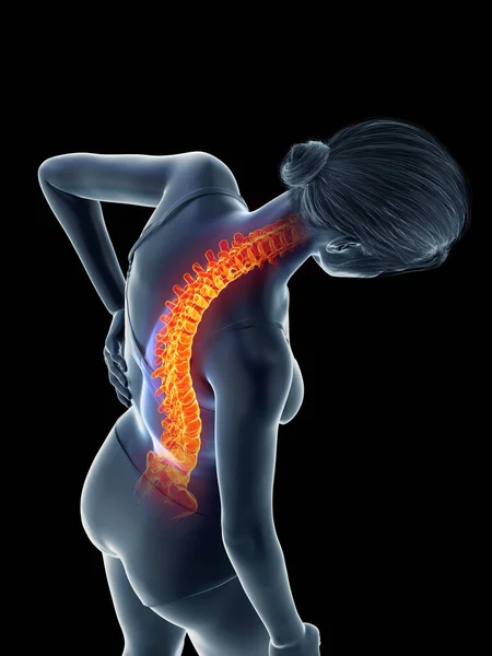 Mujer Con Espalda Dolorida Ilustración —  Fotos de Stock