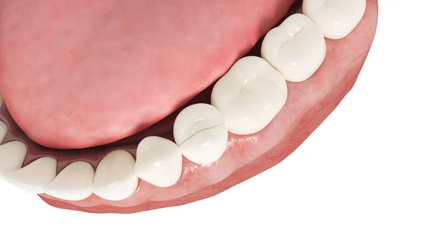 白い背景に孤立した壊れた歯 イラスト — ストック写真