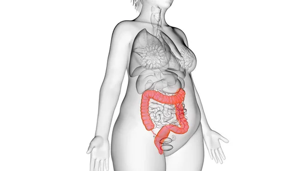 Obese Vrouw Dikke Darm Illustratie — Stockfoto