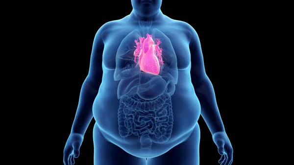 Das Herz Des Fettleibigen Mannes Illustration — Stockfoto
