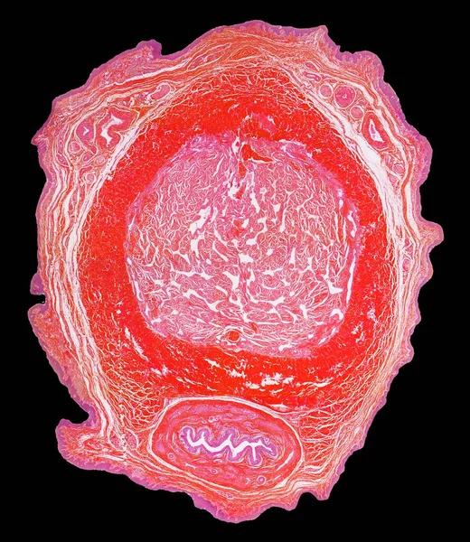 Penis Light Micrograph Section Penis Showing Corpora Cavernosa Arteries Dilate — Stock Photo, Image